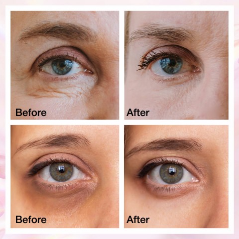 Puffiness & Dark Circles Reducing Under-Eye Cream