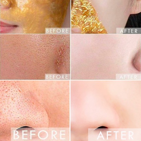 Gold Collagen Mask