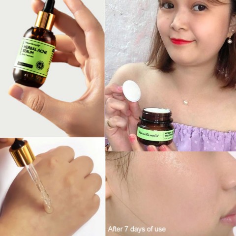 Herbal Acne Treatment Cream and Serum-Buy 1 Take 1