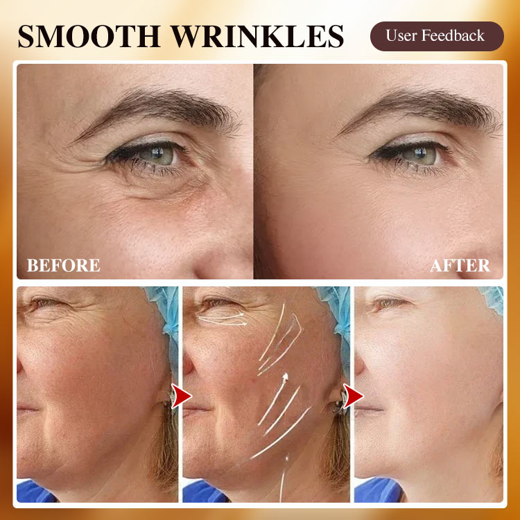  2025 New year promo buy now to save 79pesos-Gold Collagen Anti-Wrinkle Cream-Firm and lighten lines, whiten and lighten spots. The secret to restoring youthful skin